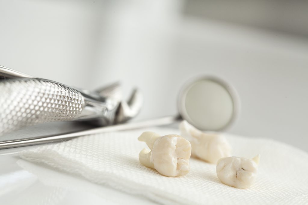 Why do we have wisdom teeth?
