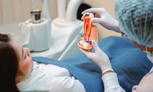 root canal singapore signs